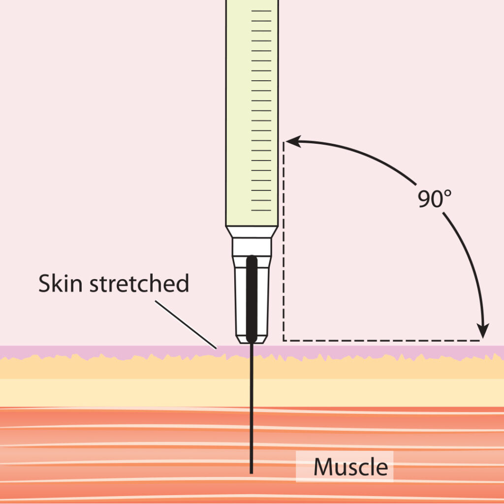 Injection Tutorials / QMed/QueerMed