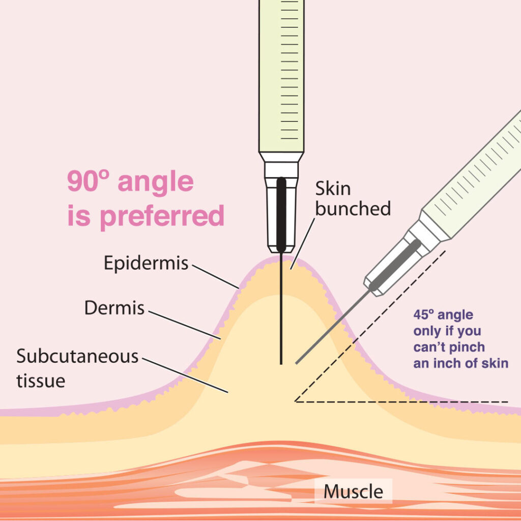 Injection Tutorials / QMed/QueerMed